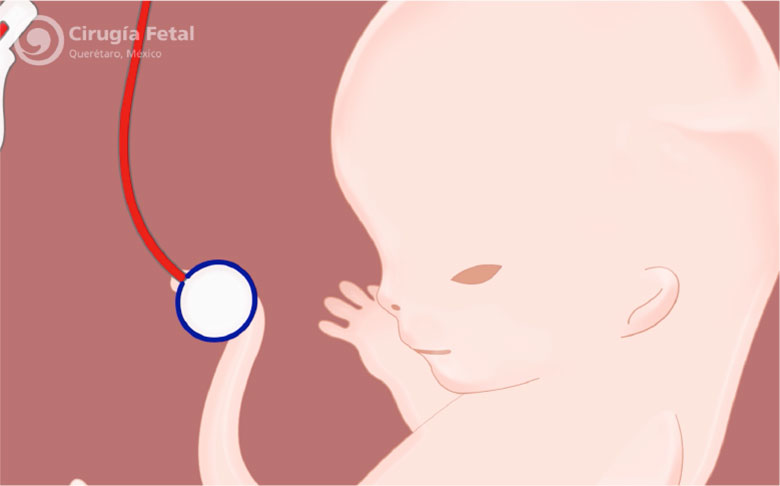 ¿Qué tipo de tratamiento existe?