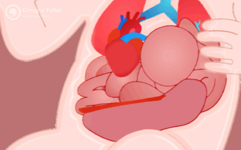 ¿Qué tipo de tratamiento existe?